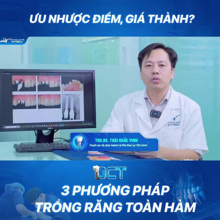 3 PHƯƠNG PHÁP TRỒNG RĂNG TOÀN HÀM PHỔ BIẾN, ĐÂU LÀ PHƯƠNG PHÁP TỐT NHẤT?