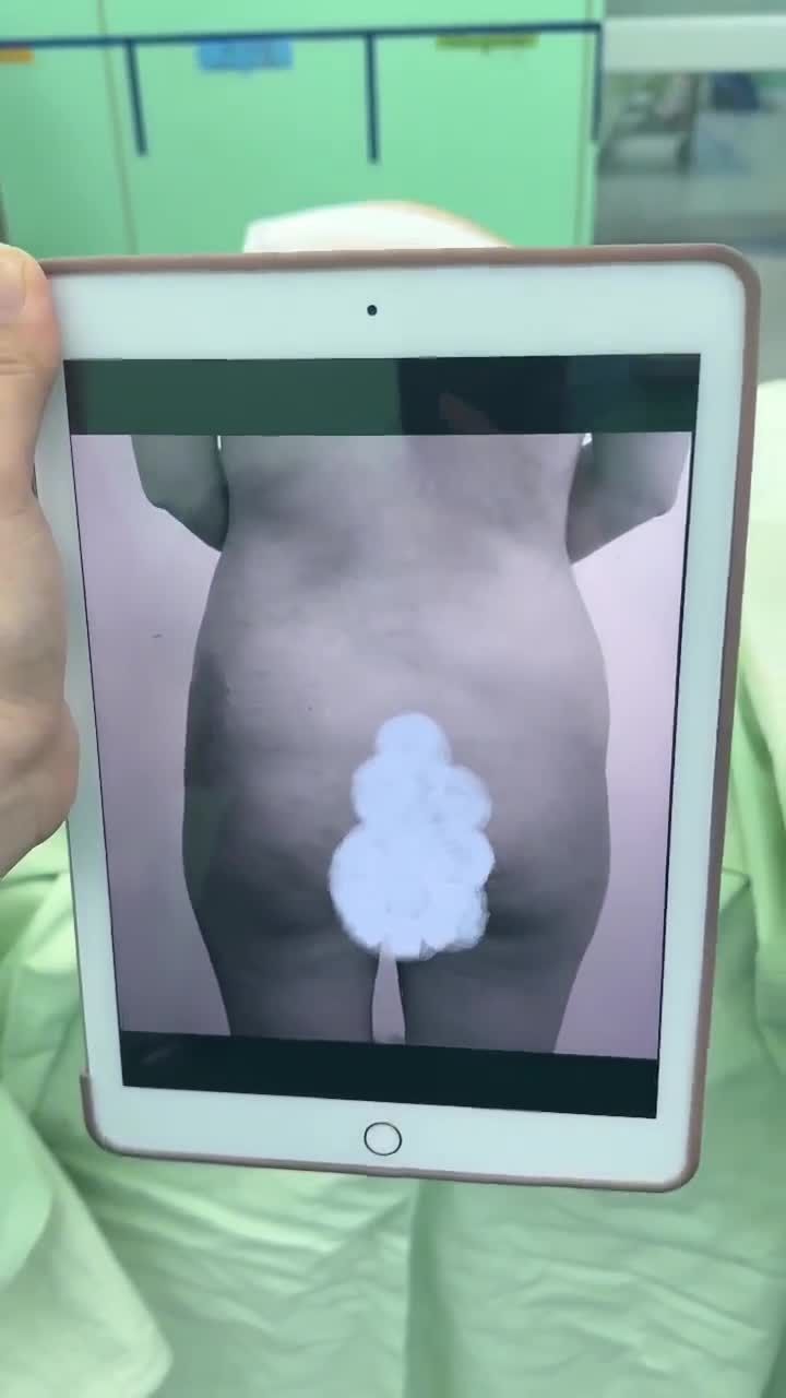 NÂNG MÔNG QUẢ TÁO