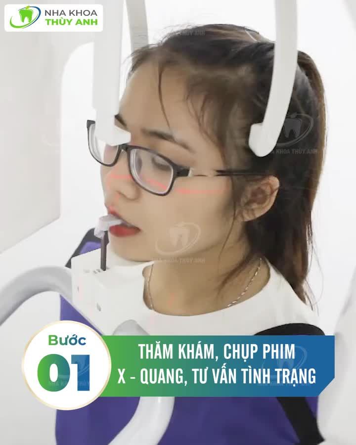 QUY TRÌNH TRỒNG RĂNG CHUẨN Y KHOA VỚI CHI PHÍ CHỈ 6.9TR