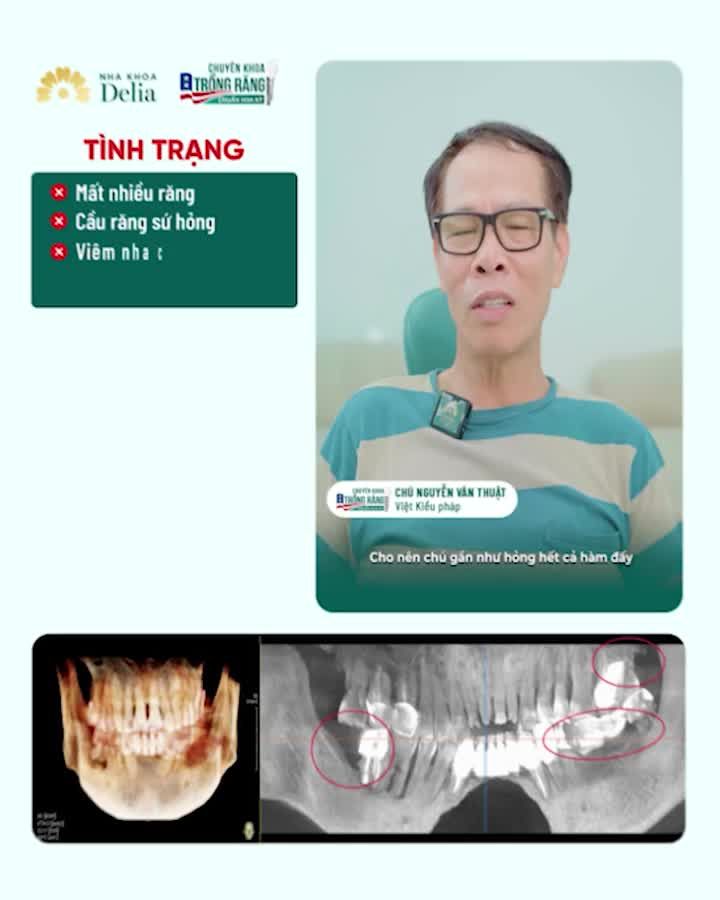 TRỒNG RĂNG IMPLANT - ĂN NHAI CHẮC KHOẺ