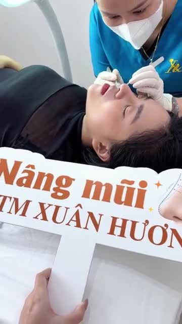 Quá trình rút chỉ mũi sau 10 ngày cho em khách hàng xinh đẹp nhà Xuân Hương