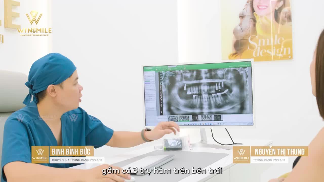 MẤT 7 RĂNG ĐƠN LẺ VÀ SỰ LỰA CHỌN PHƯƠNG PHÁP IMPLANT ĐỂ NGĂN CHẶN CÁC HẬU QUẢ KHÓ LƯỜNG