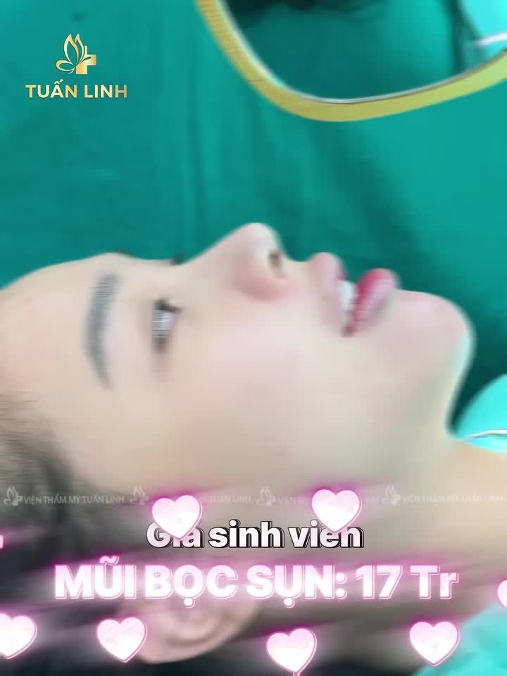 Combo mũi cằm - Nâng tầm gương mặt, sang đẹp, tự nhiên!!