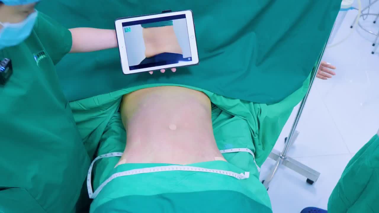 Chị K., một người phụ nữ nhưng luôn tự ti về vùng bụng đầy mỡ của mình sau khi sinh bé thứ 2, từng băn khoăn nhiều về việc hút mỡ bụng.