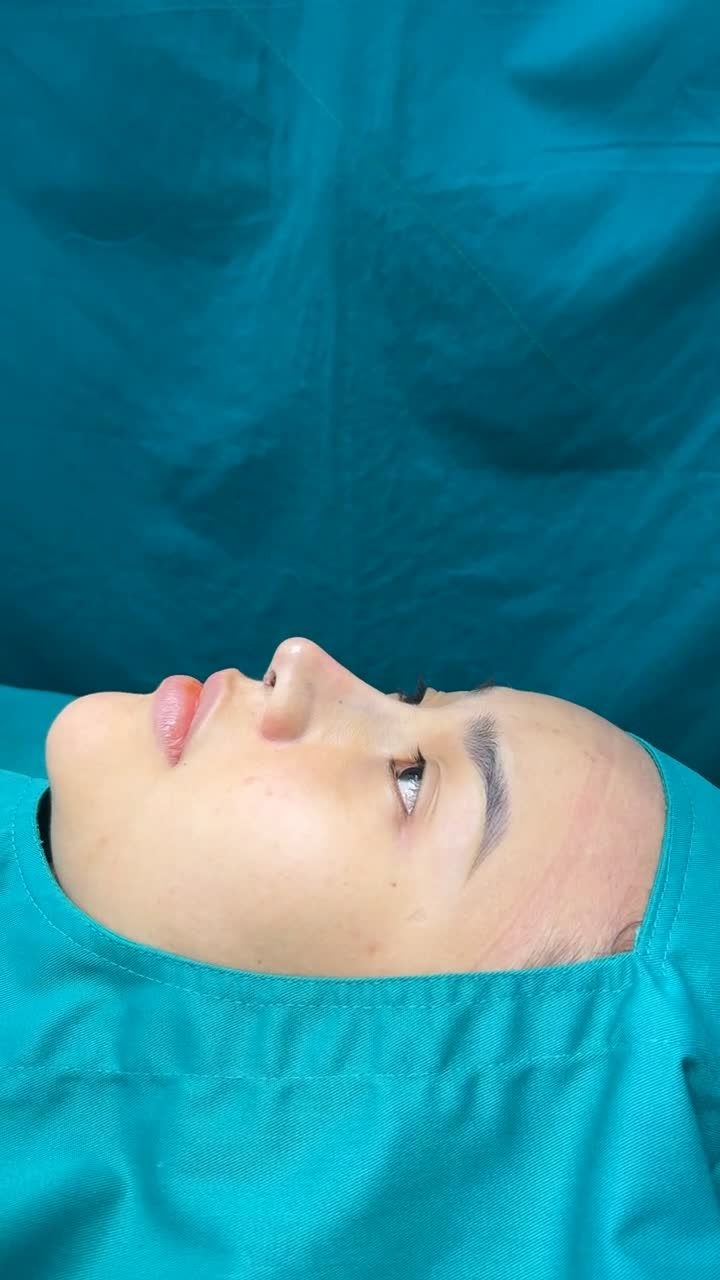 Case mũi cấu trúc vừa hoàn thành