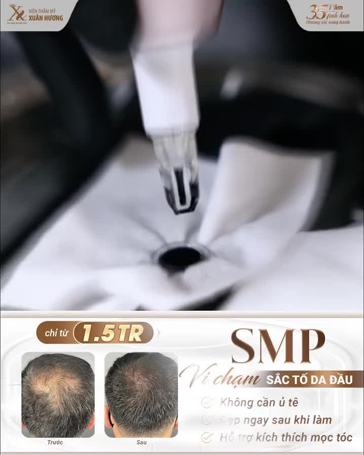 VI CHẠM SẮC TỐ DA ĐẦU – “LỜI GIẢI” CHO TÓC HÓI, TÓC THƯA