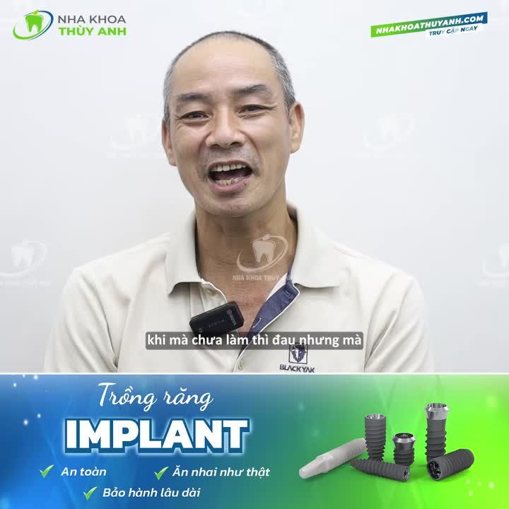 TRỒNG IMPLANT KHÔI PHỤC LẠI RĂNG SỐ 7, BÍ KÍP TẾT NÀY ĂN NGON CỦA CHÚ ƯỚC