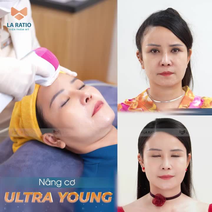 ULTRA YOUNG - ĐỈNH CAO CÔNG NGHỆ TRẺ HOÁ KHÔNG PHẪU THUẬT