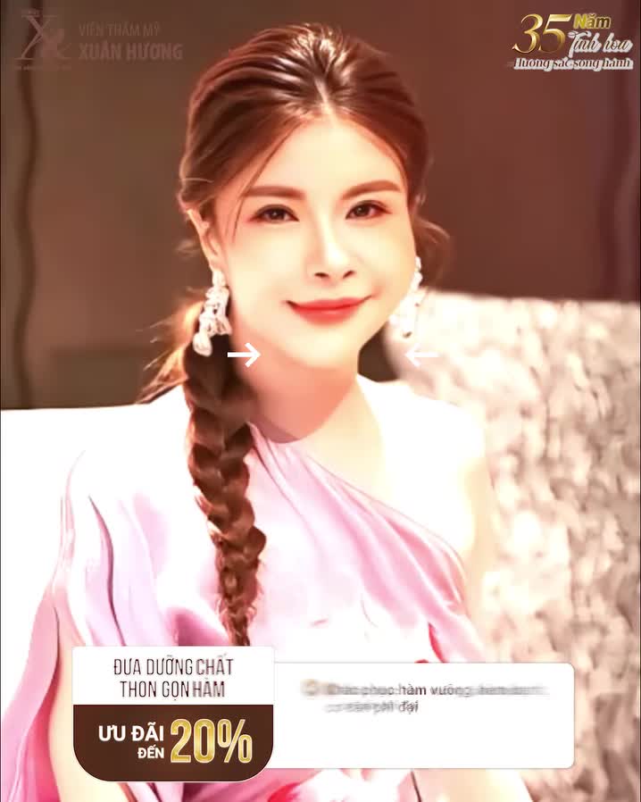 CÁI KẾT ĐẦY BẤT NGỜ SAU KHI THON GỌN HÀM TẠI VTM XUÂN HƯƠNG