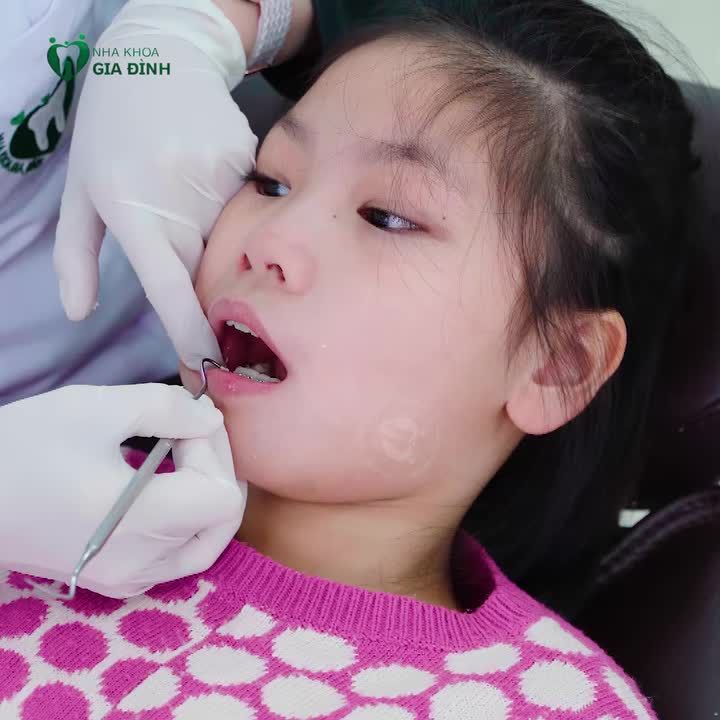 NIỀNG RĂNG SỚM CHO TRẺ - BƯỚC ĐỆM HOÀN HẢO CHO CON THÊM TỰ TIN VỮNG BƯỚC VÀO ĐỜI