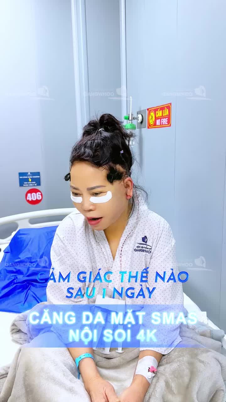 Cảm giác thế nào sau 1 ngày căng da mặt SMAS nội soi 4K tại Bệnh viện thẩm mỹ Gangwhoo?