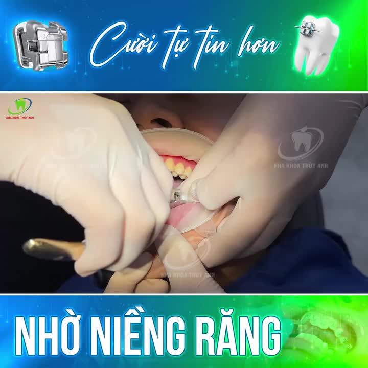 CHIA TAY RĂNG MÓM, ĐÓNG KÍN KHE THƯA - CẢM XÚC CỦA CHÀNG TRAI TRẺ NGÀY THÁO MẮC CÀI