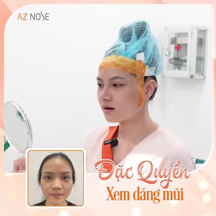 ĐẶC QUYỀN XEM DÁNG MŨI TẠI AZ NOSE