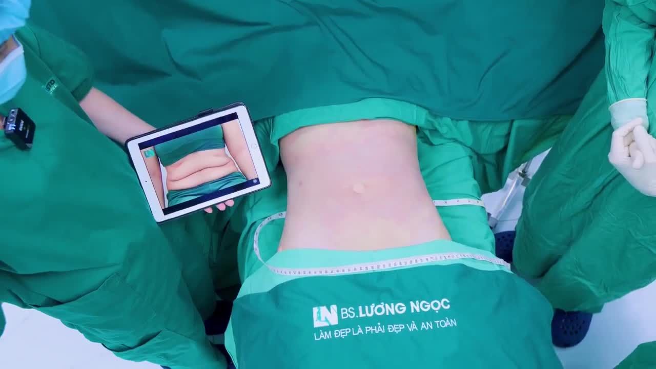 Từng kỳ vọng vào ca hút mỡ từ một bác sĩ nổi tiếng trên mạng xã hội, chị khách nhận về kết quả thất vọng ê hề: không chỉ mỡ không giảm, mà da còn chảy xệ và trùng nhão hơn trước.