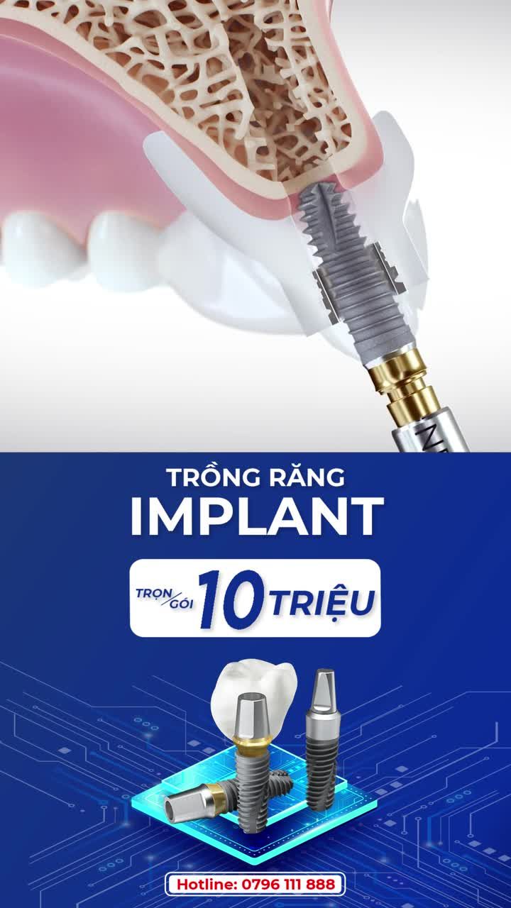 TRỒNG RĂNG IMPLANT TIẾT KIỆM TRỌN GÓI CHỈ 10 T.RIỆU