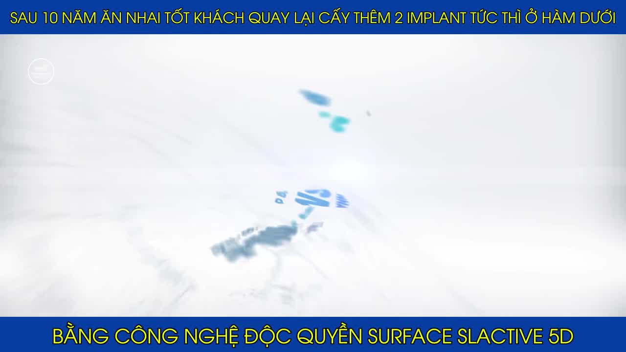 Sau 10 năm ăn nhai tốt, anh Doanh trở lại cấy thêm 2 răng implant. Quy trình cấy ghép diễn ra nhanh chóng, an toàn và hiệu quả.