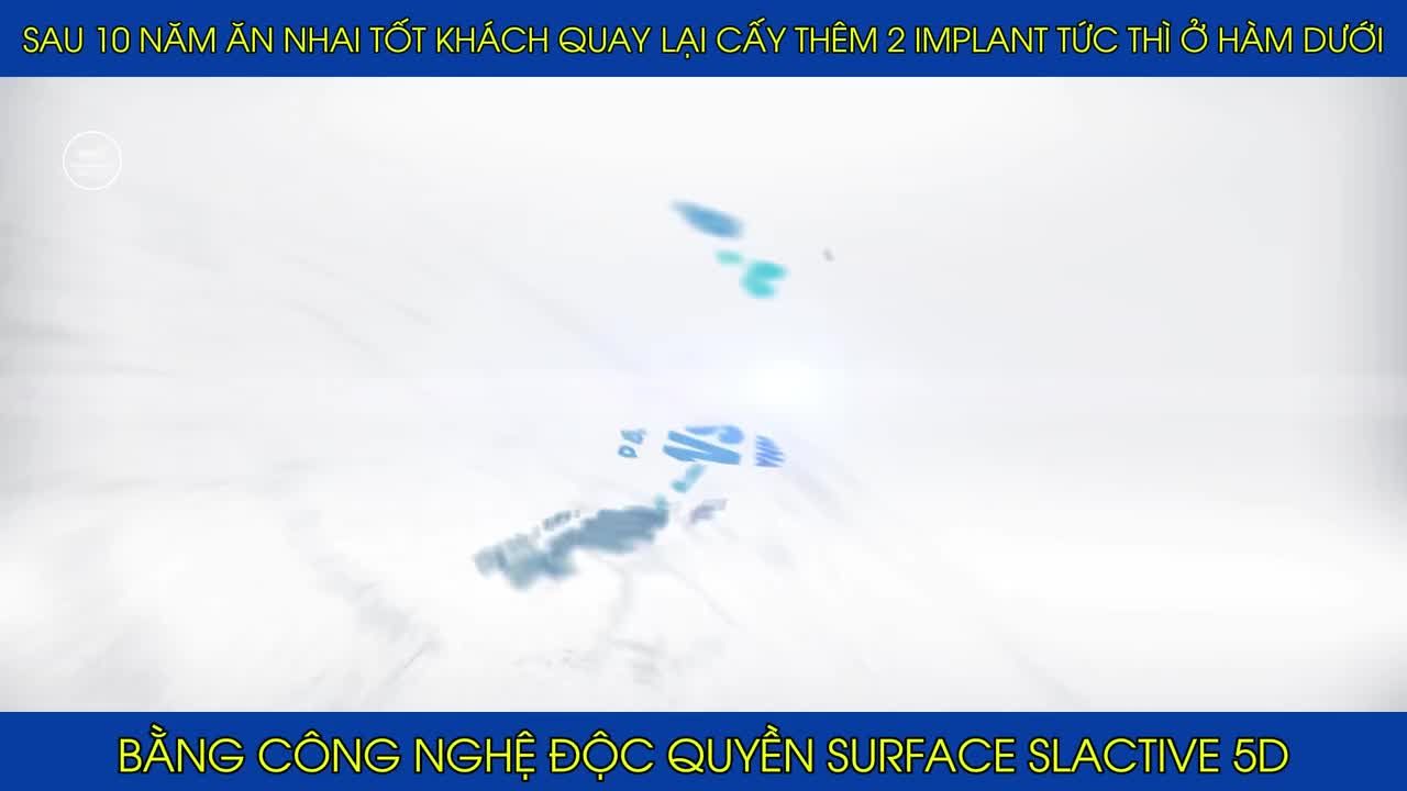 Sau 10 năm ăn nhai tốt, anh Doanh trở lại cấy thêm 2 răng implant. Quy trình cấy ghép diễn ra nhanh chóng, an toàn và hiệu quả.