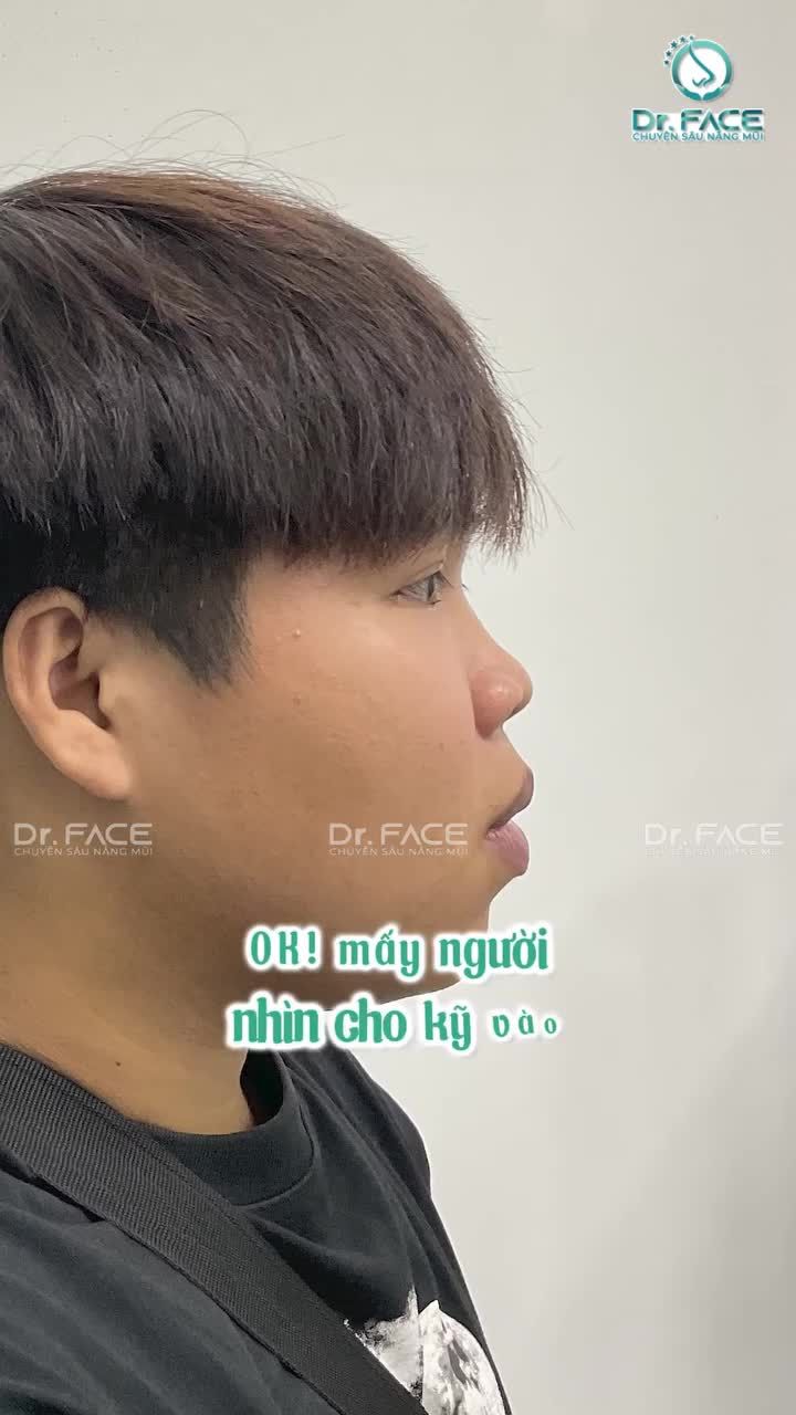 Nhất Định Phải Cố Gắng Vì Một Vẻ Ngoài Tỏa Sáng Hơn…
