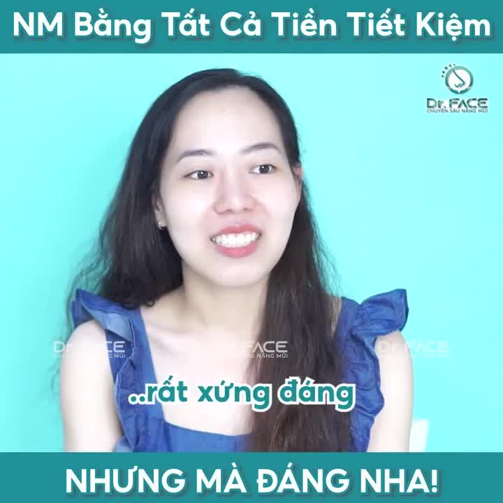 Nâng Mũi Bằng Tất Cả Tiền Tiết Kiệm Nhưng Rất Đáng