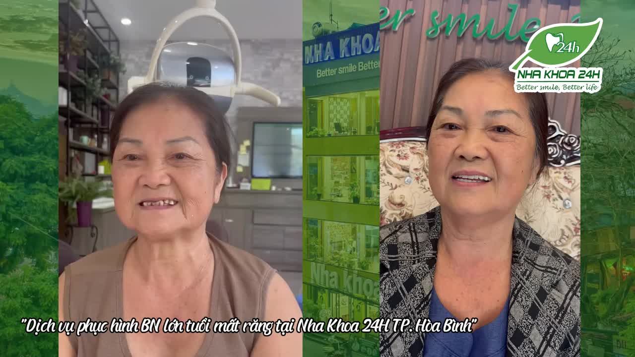 Tự Tin Ăn Nhai Với Dịch Vụ Phục Hình Tại Nha Khoa 24H