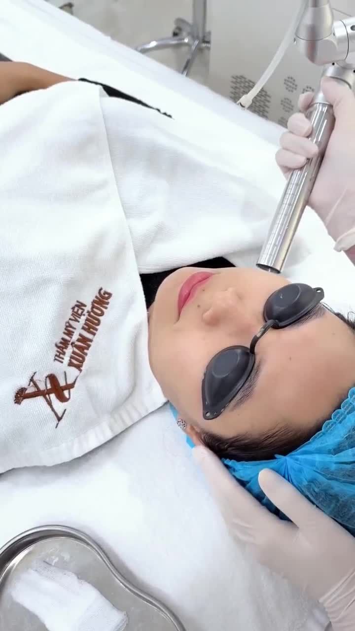 Trị liệu Trẻ hóa da Baby Face - tái tạo da từ sâu bên trong không xâm lấn cho làn da mướt mịn như da em bé