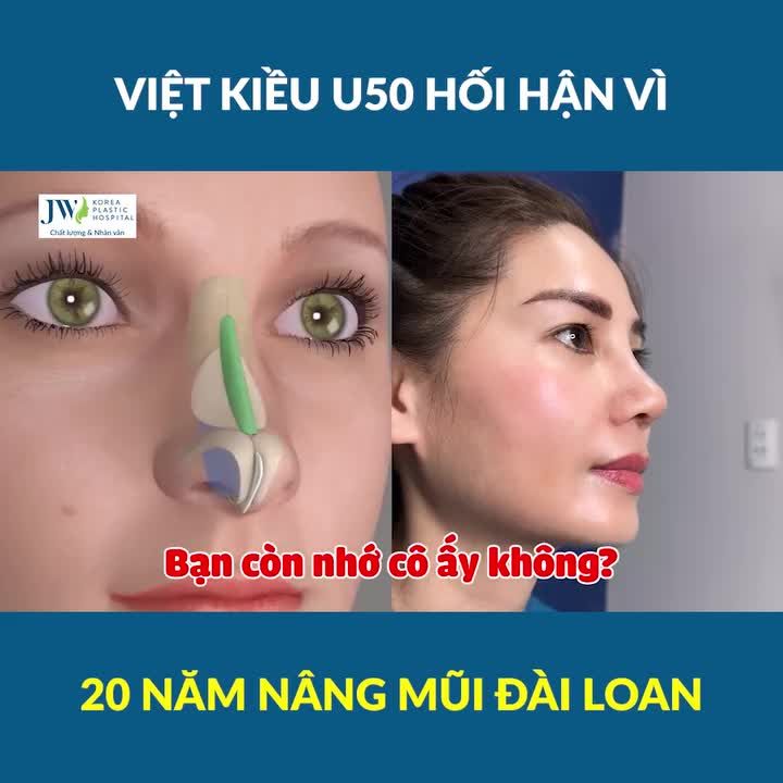 Bác sĩ Tú Dung NÂNG MŨI CỨU NGƯỜI giúp Việt kiều U50 thoát cảnh MŨI HẾCH NGƯỢC, CO RÚT sau 20 năm