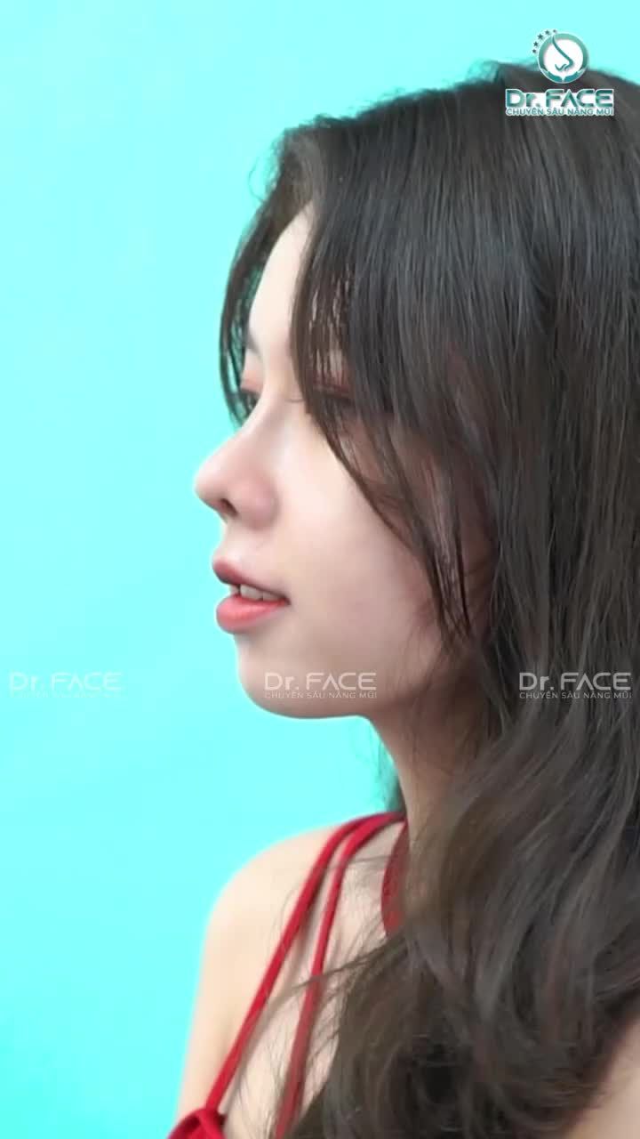 EM CHỌN ĐẸP NHÂN TẠO NHA