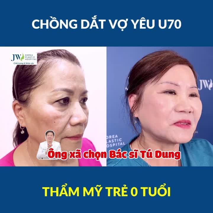 Chồng mê Bác sĩ Tú Dung quyết dắt vợ đến JW CẢI LÃO GƯƠNG MẶT đẹp như HOA HẬU