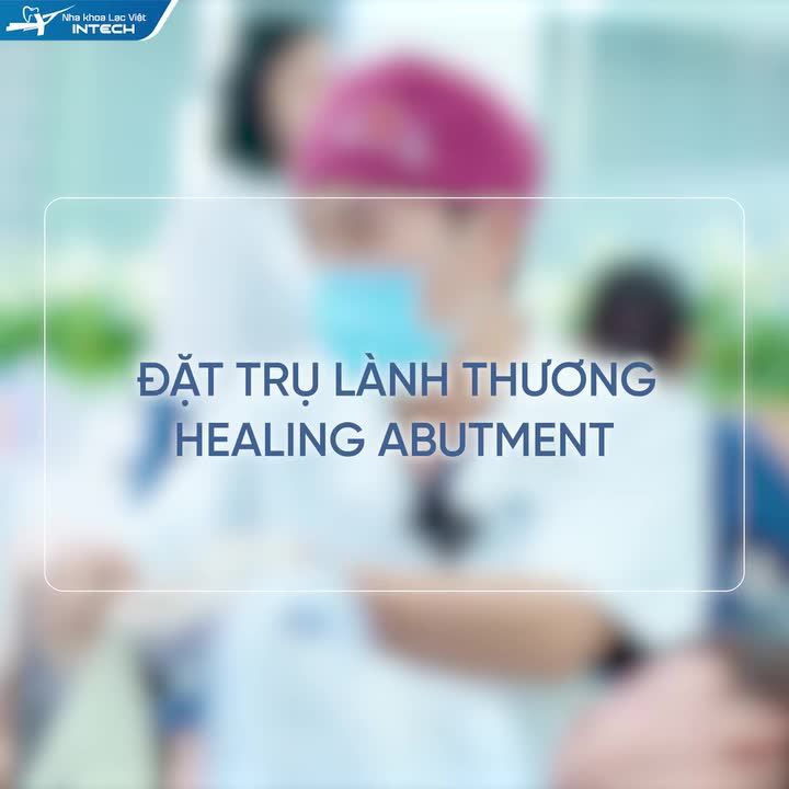 2 THỜI ĐIỂM QUAN TRỌNG VÀ CHI TIẾT QUÁ TRÌNH ĐẶT TRỤ LÀNH THƯƠNG CÁ NHÂN HÓA TẠI NHA KHOA LẠC VIỆT INTECH