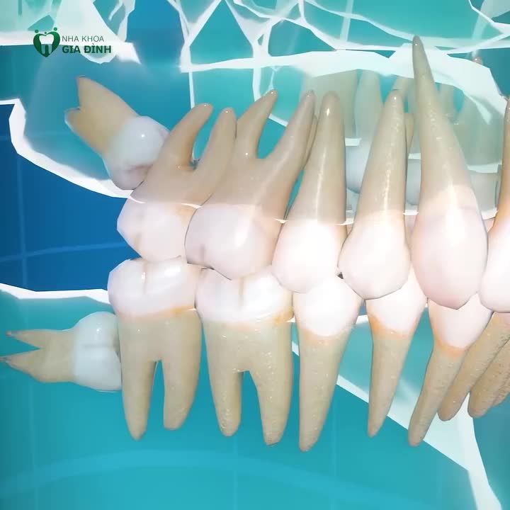 RĂNG KHÔN KHÓ - ĐÃ CÓ NHA KHOA GIA ĐÌNH LO️