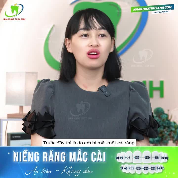 MẤT 1 RĂNG MÀ XÔ LỆCH LUÔN CẢ HÀM RĂNG, KHÁCH HÀNG NỮ TÌM LẠI NỤ CƯỜI ĐỀU ĐẸP NHƯ THẾ NÀO?