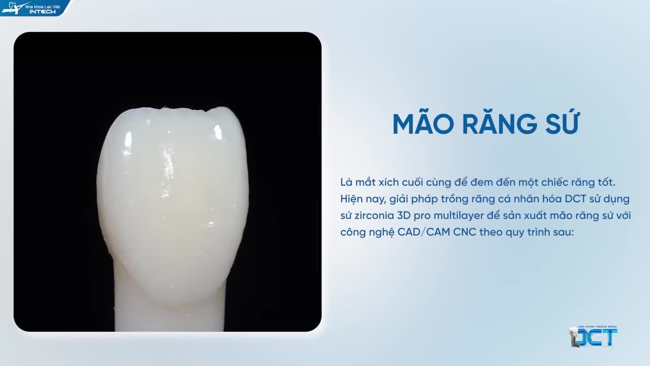 LÝ DO MÃO RĂNG SỨ LÀ MẮT XÍCH QUAN TRỌNG TẠO NÊN 1 CHIẾC RĂNG IMPLANT TỐT