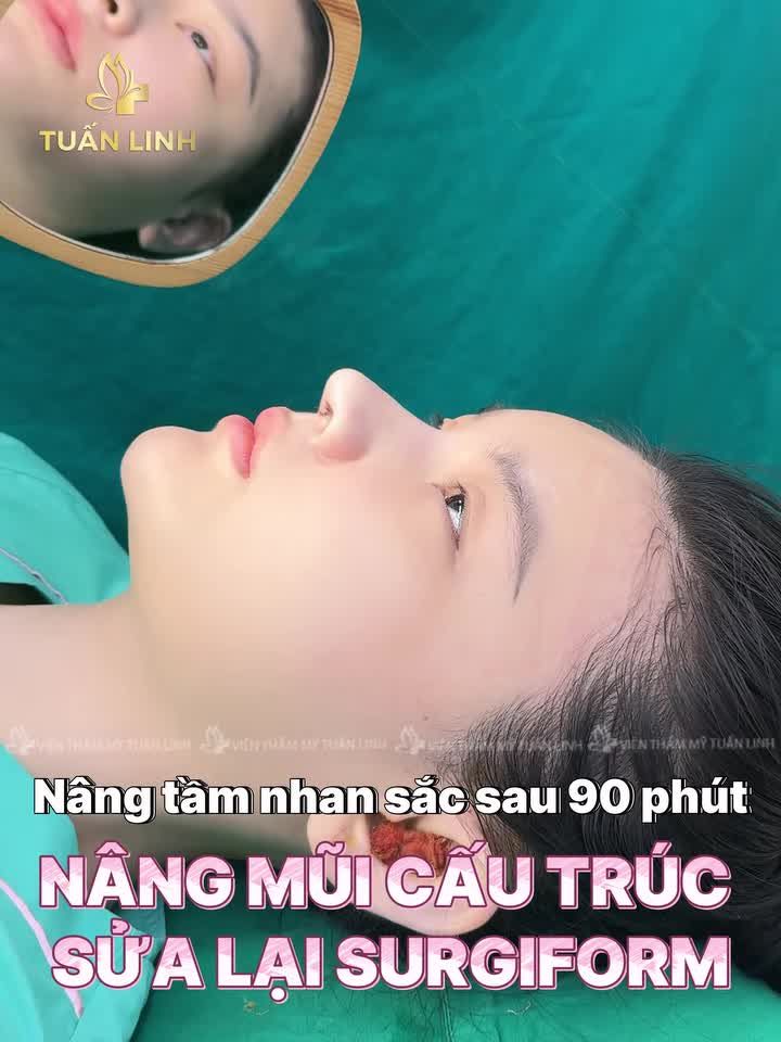 Sự Tự Tin Bắt Đầu Từ Một Dáng Mũi Hoàn Hảo!!