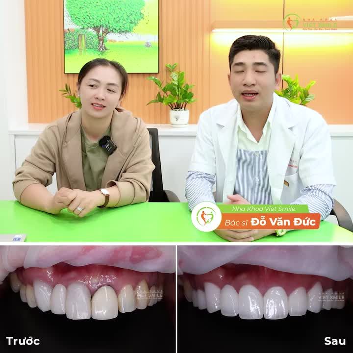 Lý do vì sao khách hàng "chốt" Combo "Cấy Implant Răng Sứ" tại VIET SMILE