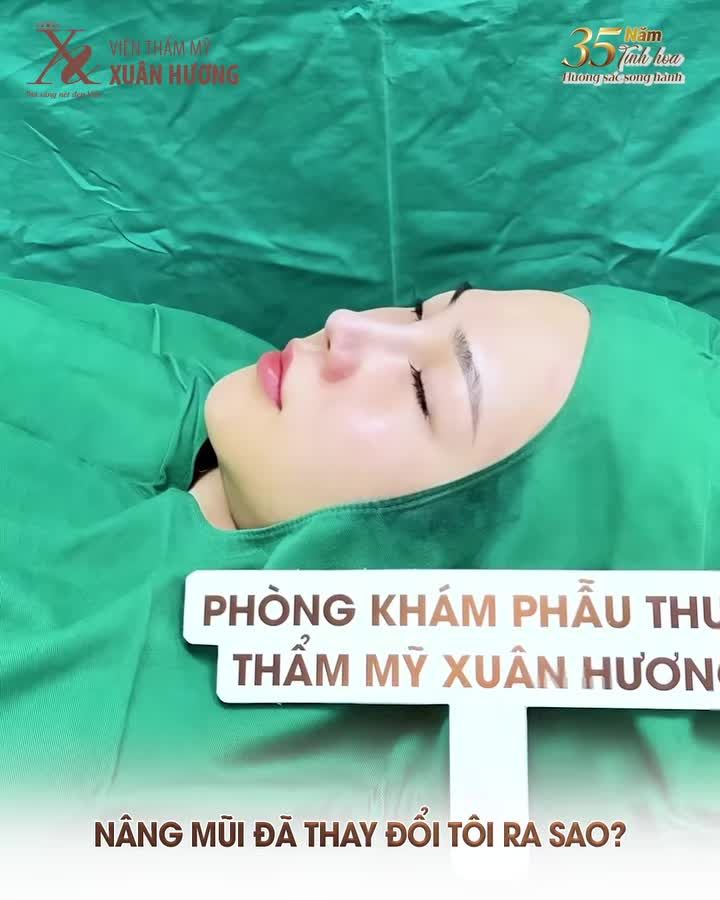 Sở hữu dáng mũi thanh tú không còn là mơ ước  Với dịch vụ nâng mũi nhà Xuân Hương