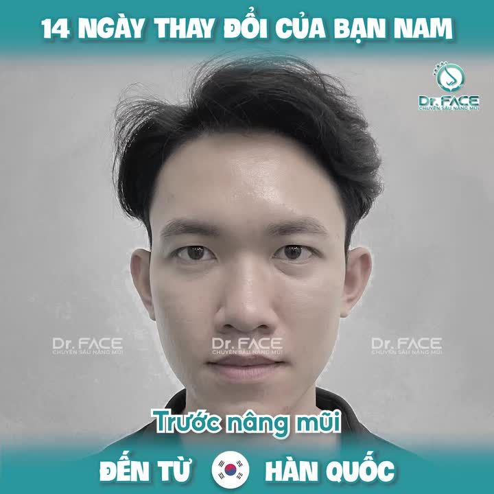 14 NGÀY thay đổi của BẠN NAM đến từ HÀN QUỐC