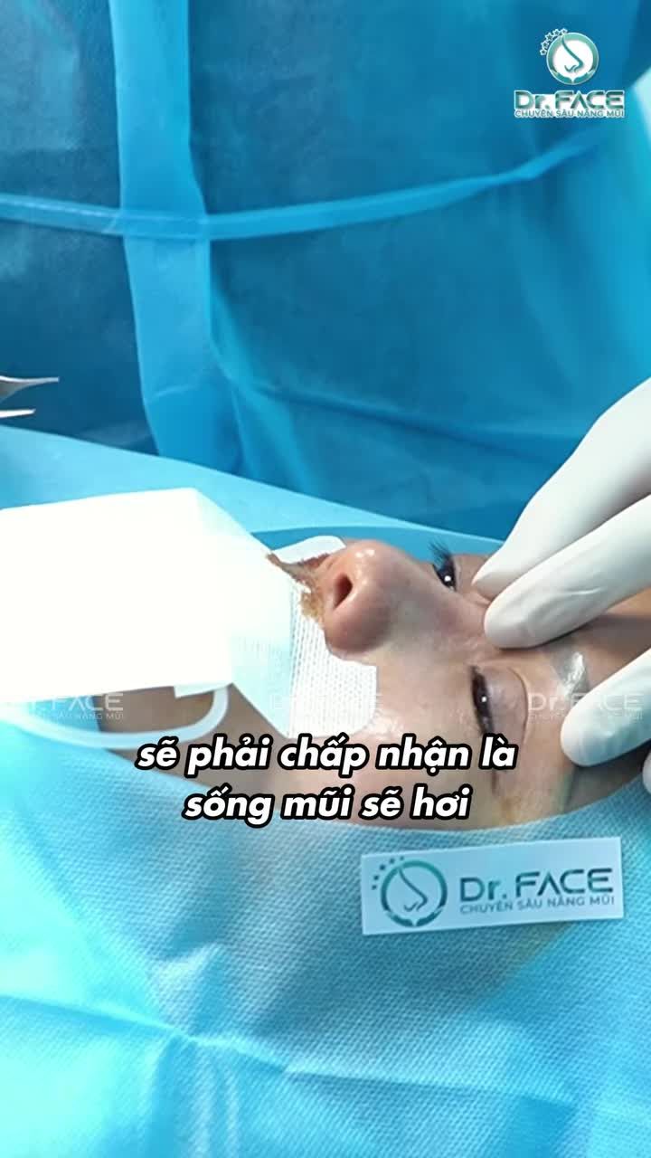 Mũi CẤU TRÚC này nên chọn SỤN TAI hay TRUNG BÌ MỠ?