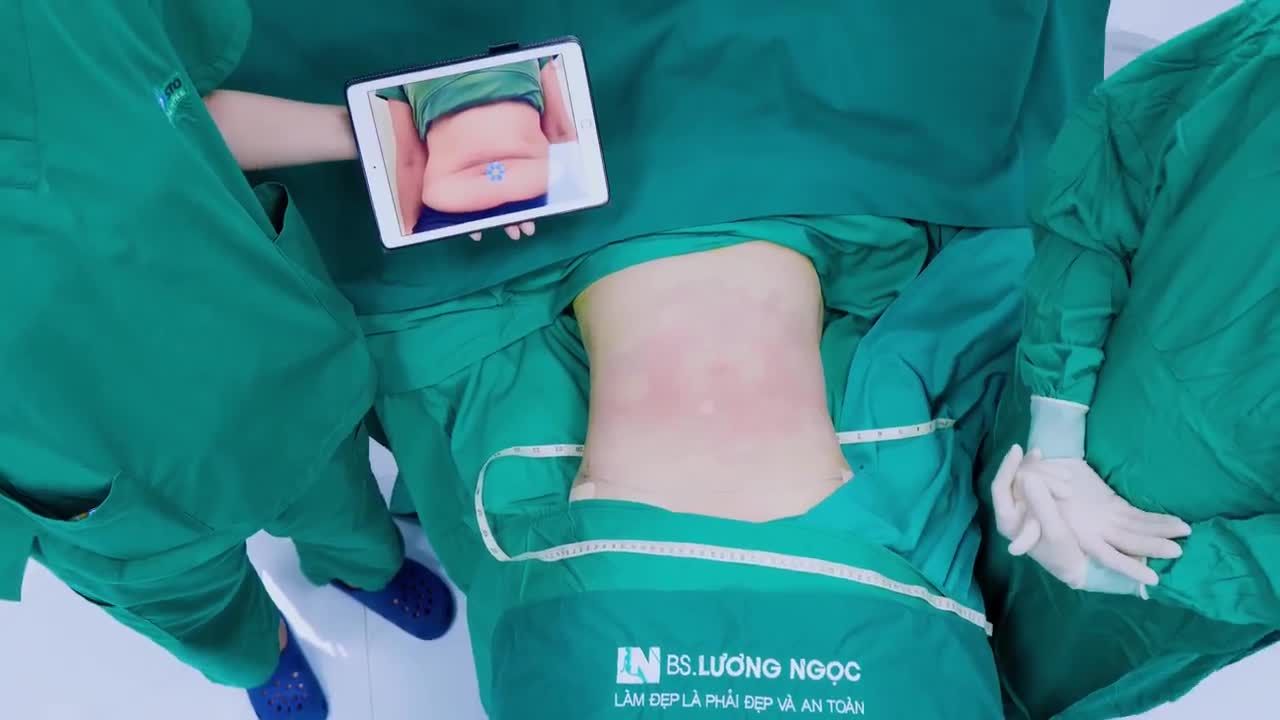 Tình trạng mỡ thừa và da chảy xệ sau sinh luôn là nỗi ám ảnh của rất nhiều chị em.
