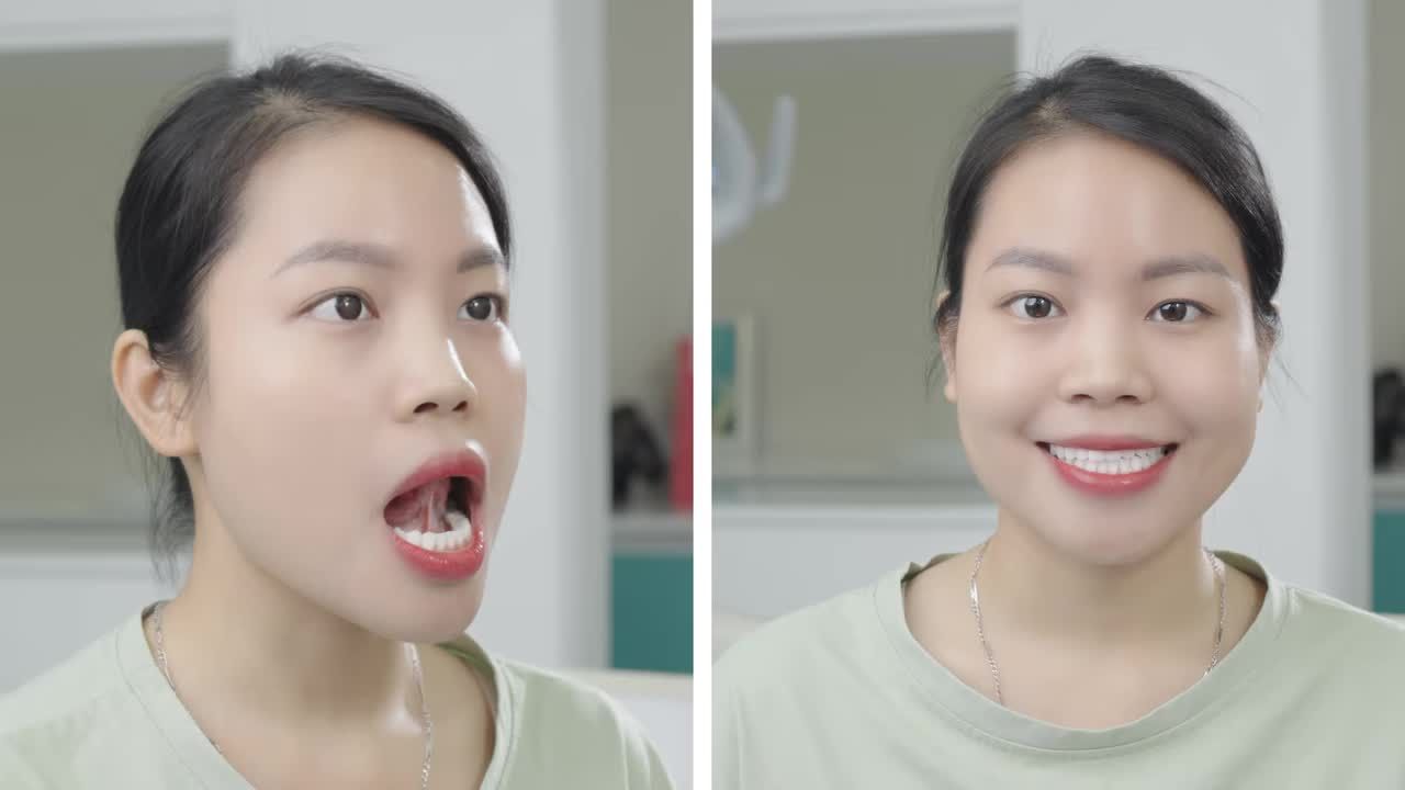 BÀI TẬP MEWING NIỀNG RĂNG CHỐNG HÓP MÁ, HÓP THÁI DƯƠNG (P1)