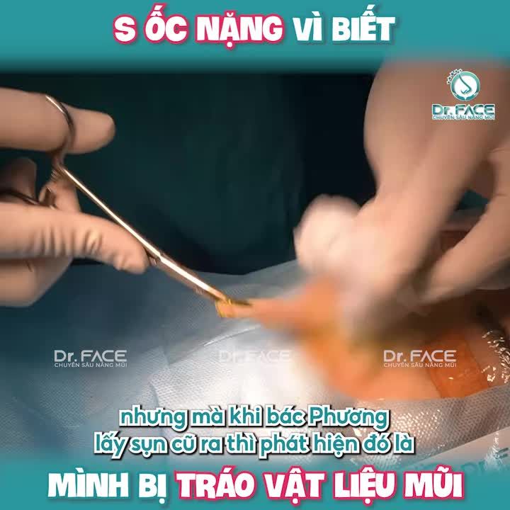 SỐC NẶNG vì biết mình BỊ TRÁO VẬT LIỆU MŨI