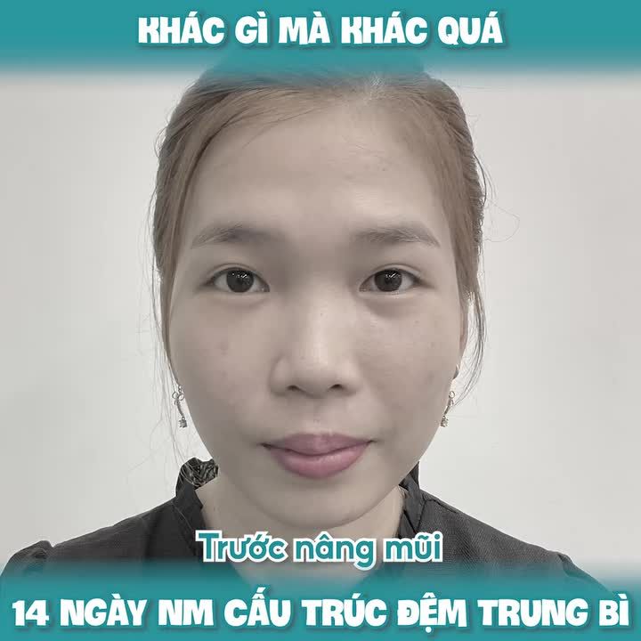 KHÁC GÌ MÀ KHÁC QUÁ - 14 ngày NM Cấu Trúc Đệm Trung Bì