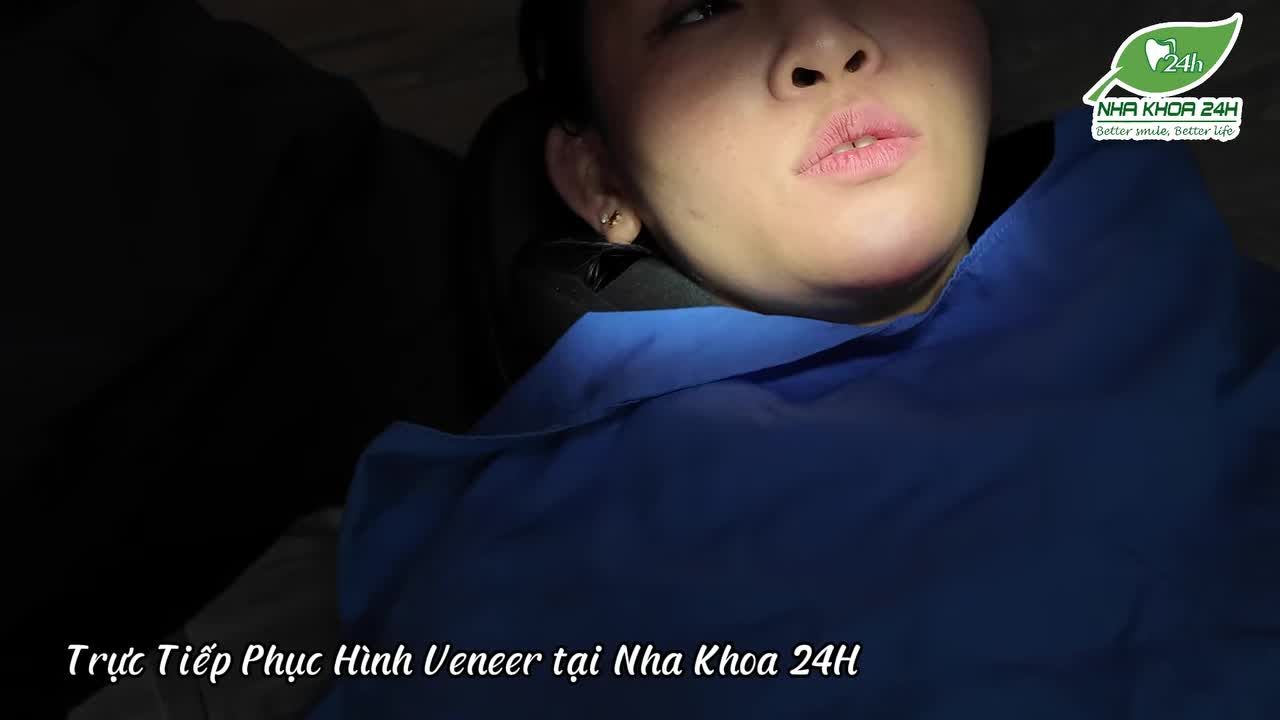 Phục Hình Thẫm Mỹ Miếng Dán Sứ Veneer Đóng Kẽ Thưa Tại Nha Khoa 24H