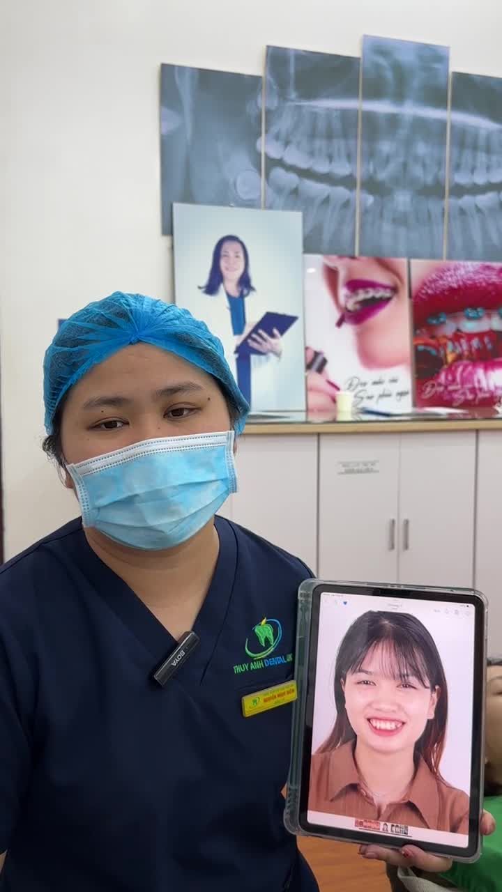 Phân tích kế hoạch điều trị cho ca gắn mắc cài mới bắt đầu quá trình chỉnh nha cho bạn Hồng Ánh tại Nha Khoa Thuỳ Anh