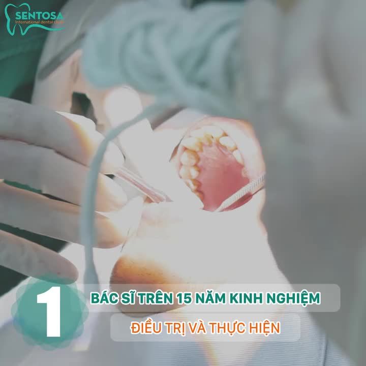 TOP 5 LÝ DO NÊN LỰA CHỌN TRỒNG RĂNG IMPLANT TẠI NHA KHOA SENTOSA