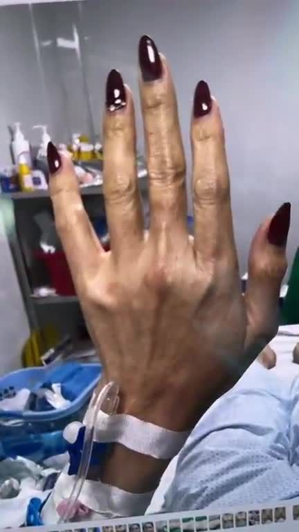 Trẻ hoá bàn tay = tạo bàn tay BÚP MĂNG với Dr Vương