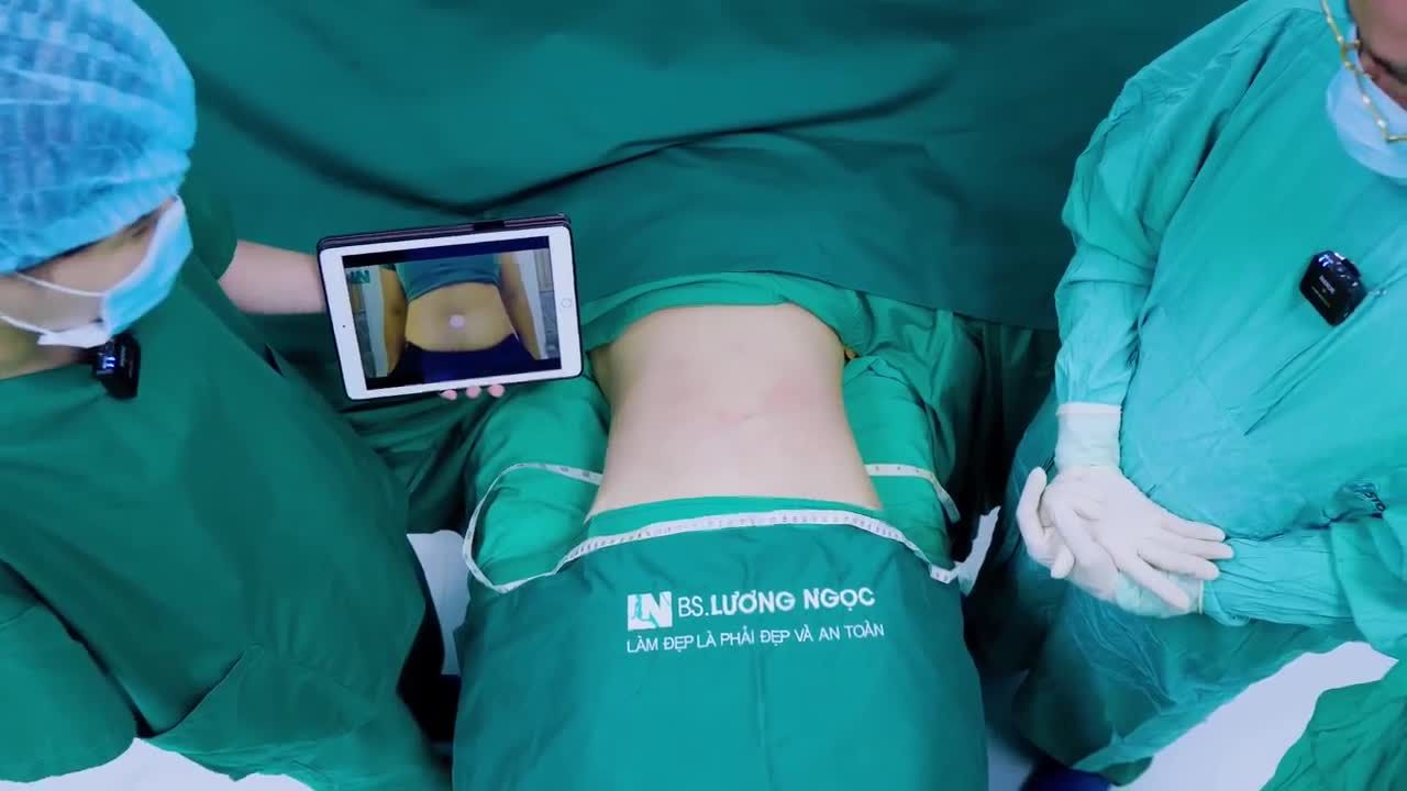 Hôm qua, chị khách tìm đến chúng tôi với dự định tham khảo thông tin thôi, bởi vì chị rất lo về việc phải căng cắt da, “chị có người bạn đi hút mỡ mà bị để lại vết sẹo dài, rồi ‘căng da dời rốn’ nhìn xấu mà kỳ lắm”- chị chia sẻ.