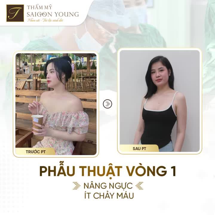 " Từ khi làm ngực xong em cảm thấy rất yêu thương bản thân mình, ngày nào cũng ngắm mình trong gương".