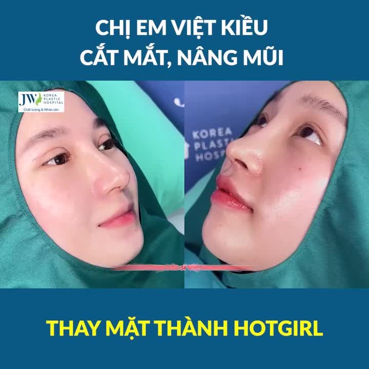 CỰC MÊ Bác sĩ Tú Dung CẮT MẮT, NÂNG MŨI cho Cặp chị em Việt kiều THAY MẶT hoá HOTGIRL sang chảnh