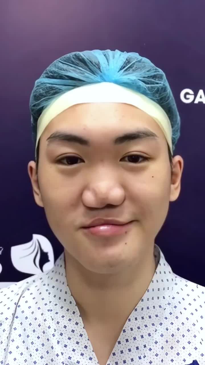 Trả lại nụ cười cho anh chàng bị "sứt môi hở hàm ếch"