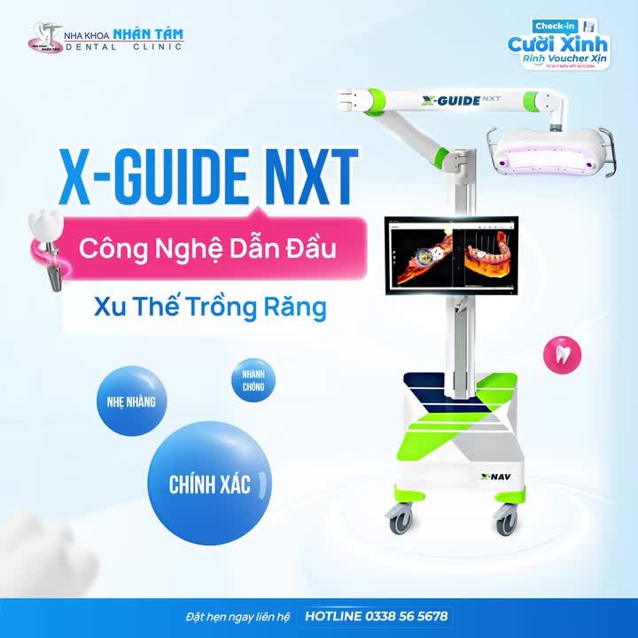 X-Guide NXT: Từ trồng răng truyền thống đến công nghệ dẫn đầu xu thế